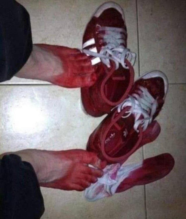 Acid Picdump. Part 2 (95 pics)