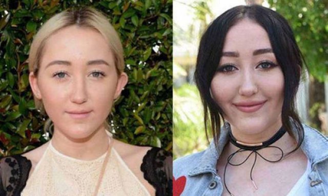 Plastic Surgery Went Wrong (20 pics)