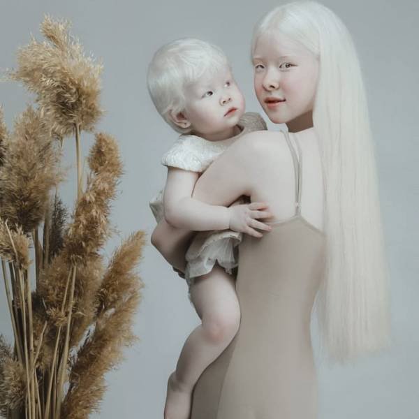 Beautiful Photos Of Albino Sisters (15 pics)