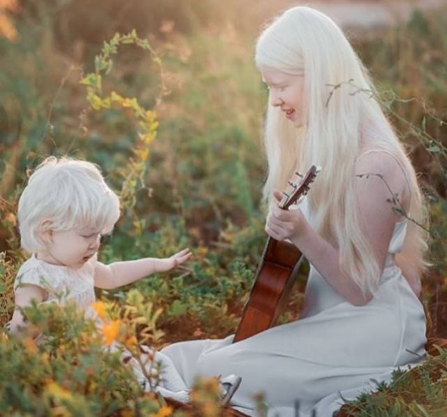 Beautiful Photos Of Albino Sisters (15 pics)