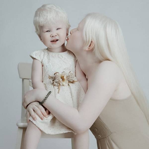 Beautiful Photos Of Albino Sisters (15 pics)