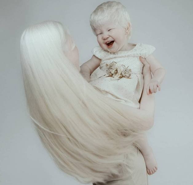 Beautiful Photos Of Albino Sisters (15 pics)