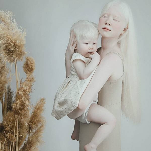 Beautiful Photos Of Albino Sisters (15 pics)