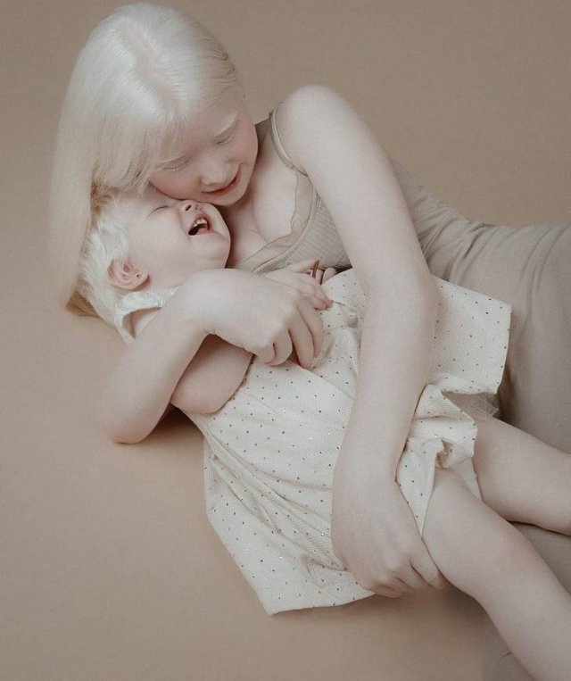 Beautiful Photos Of Albino Sisters (15 pics)