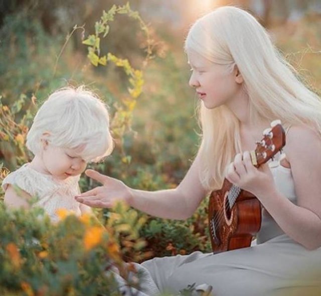 Beautiful Photos Of Albino Sisters (15 pics)