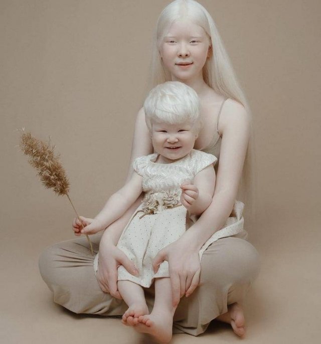 Beautiful Photos Of Albino Sisters (15 pics)