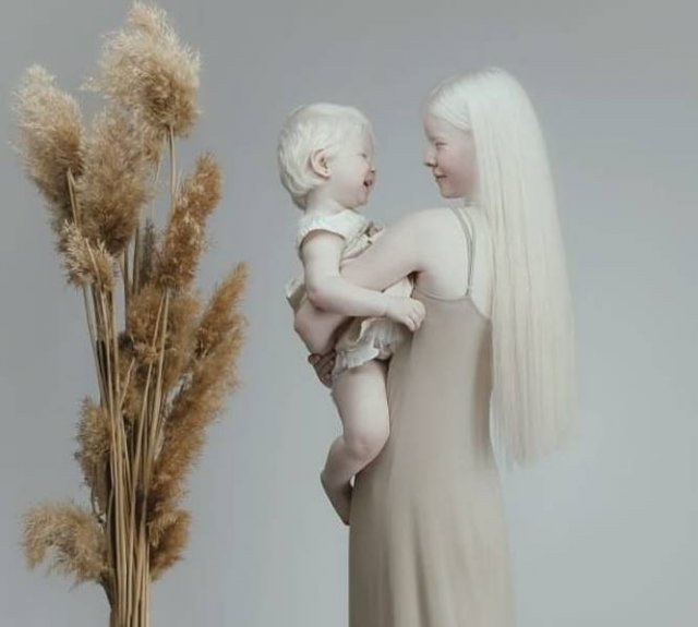 Beautiful Photos Of Albino Sisters (15 pics)