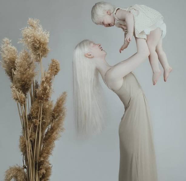 Beautiful Photos Of Albino Sisters (15 pics)