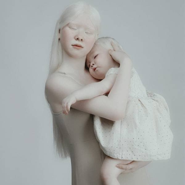 Beautiful Photos Of Albino Sisters (15 pics)