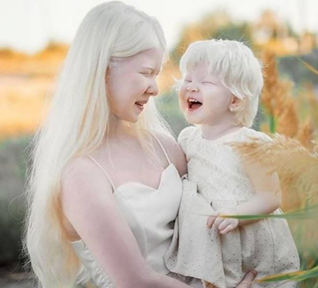 Beautiful Photos Of Albino Sisters (15 pics)