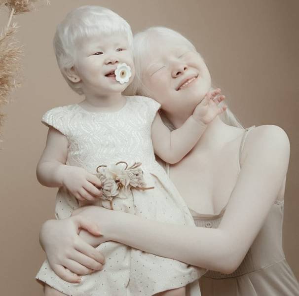 Beautiful Photos Of Albino Sisters (15 pics)