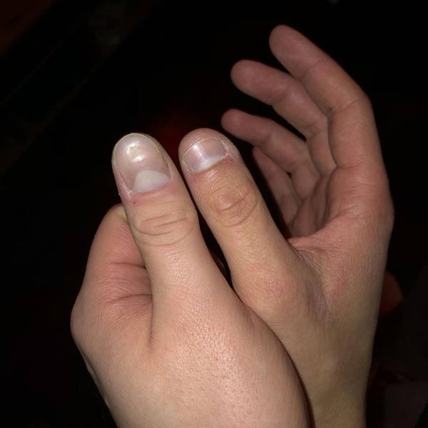 Acid Picdump. Part 2 (94 pics)