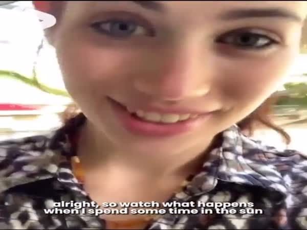 This Girl's Eyes Change Color With The Sun