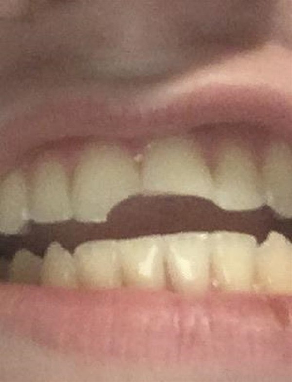 This Is How Pain Looks Like (25 pics)
