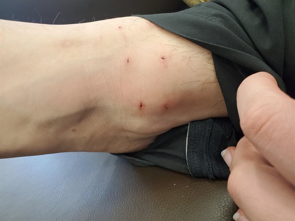 This Is How Pain Looks Like (25 pics)