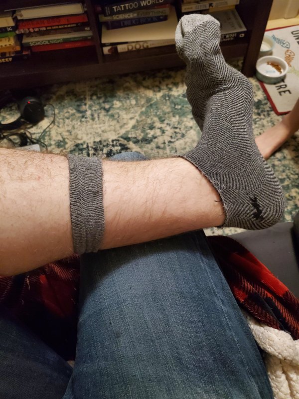 This Is How Pain Looks Like (25 pics)