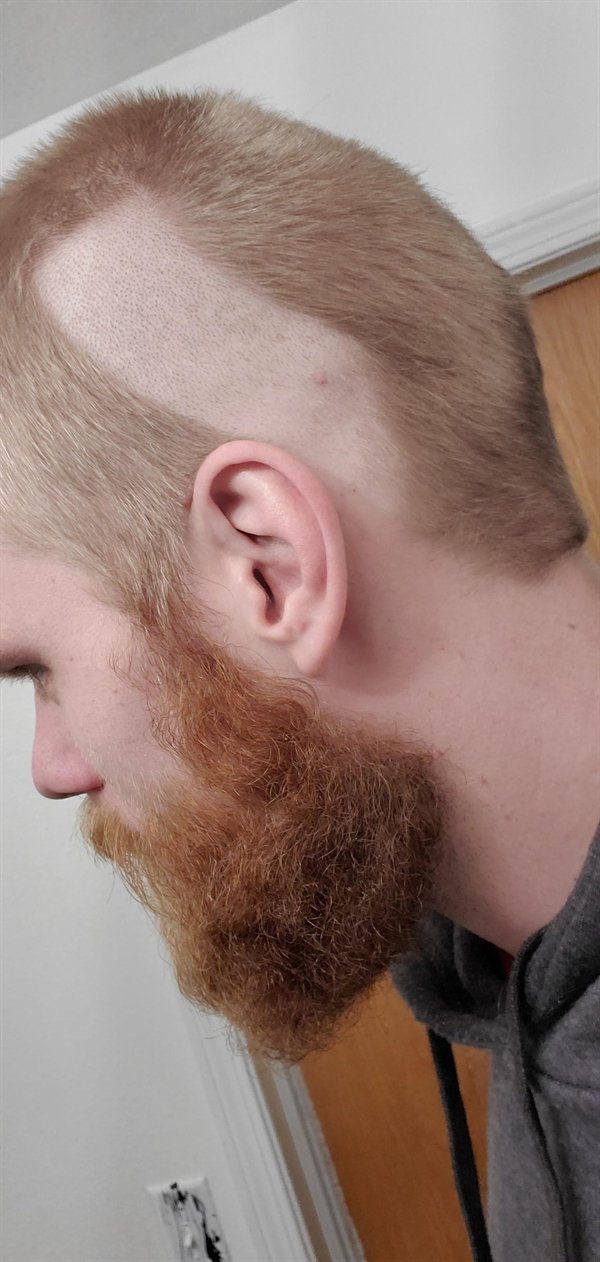 This Is How Pain Looks Like (25 pics)