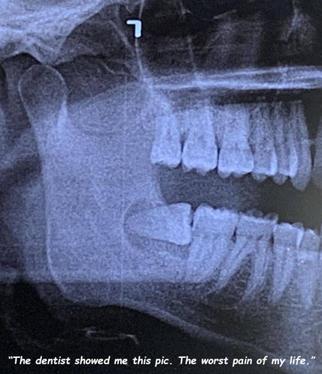 Bad Days Happen (50 pics)