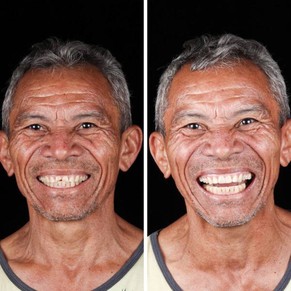 Brazilian Dentist Treats Poor People For Free (22 pics)