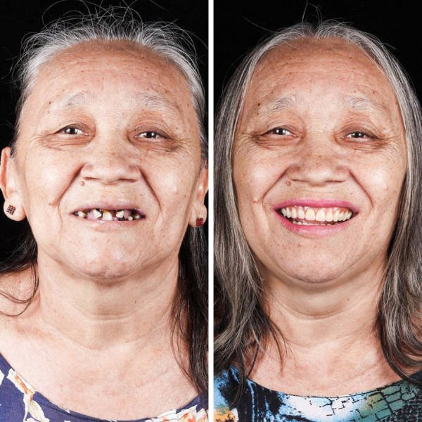 Brazilian Dentist Treats Poor People For Free (22 pics)