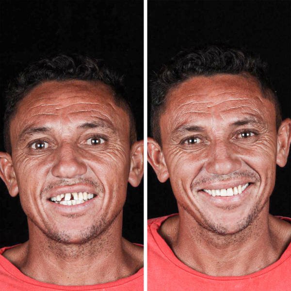 Brazilian Dentist Treats Poor People For Free (22 pics)