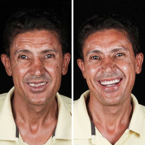 Brazilian Dentist Treats Poor People For Free (22 pics)