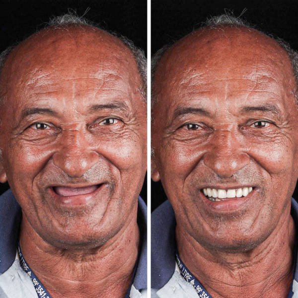 Brazilian Dentist Treats Poor People For Free (22 pics)