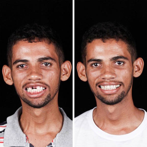 Brazilian Dentist Treats Poor People For Free (22 pics)