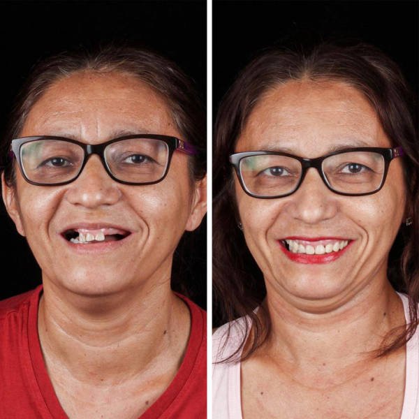 Brazilian Dentist Treats Poor People For Free (22 pics)