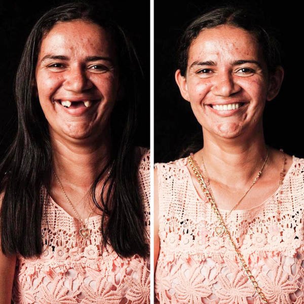 Brazilian Dentist Treats Poor People For Free (22 pics)