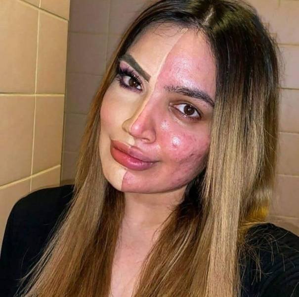 Acid Picdump. Part 1 (97 pics)