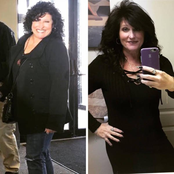 Amazing Weight Loss (45 pics) Amazing Weight Loss (45 pics)