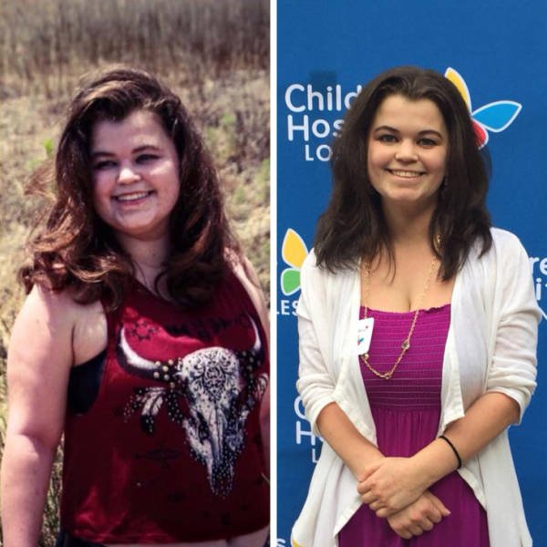 Amazing Weight Loss (45 pics) Amazing Weight Loss (45 pics)