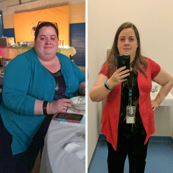 Amazing Weight Loss (45 pics) Amazing Weight Loss (45 pics)