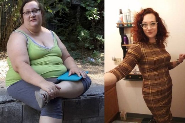 Amazing Weight Loss (45 pics) Amazing Weight Loss (45 pics)