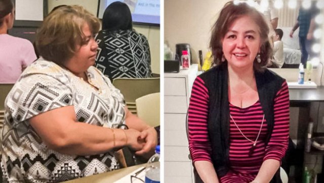 Amazing Weight Loss (45 pics) Amazing Weight Loss (45 pics)
