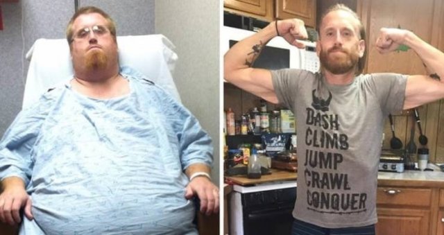 Amazing Weight Loss (45 pics) Amazing Weight Loss (45 pics)