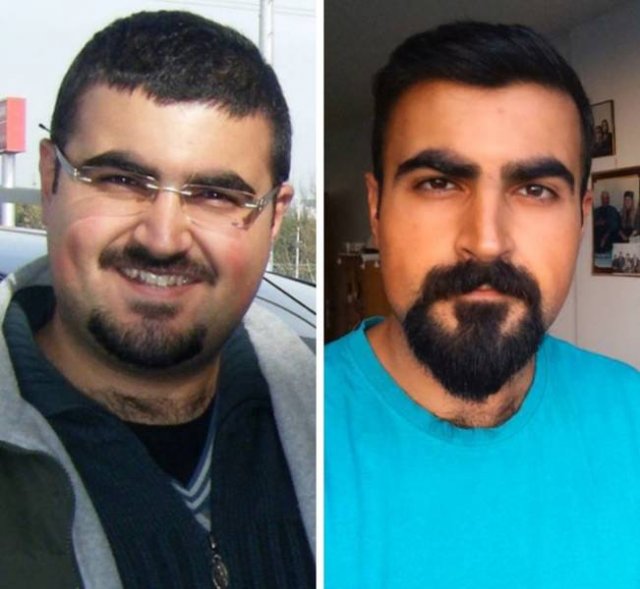 Amazing Weight Loss (45 pics) Amazing Weight Loss (45 pics)