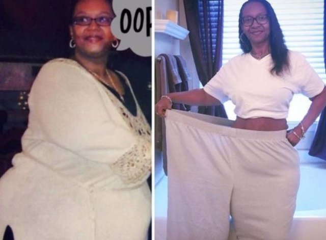 Amazing Weight Loss (45 pics) Amazing Weight Loss (45 pics)