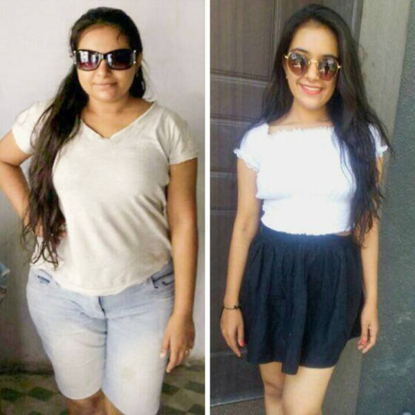 Amazing Weight Loss (45 pics) Amazing Weight Loss (45 pics)