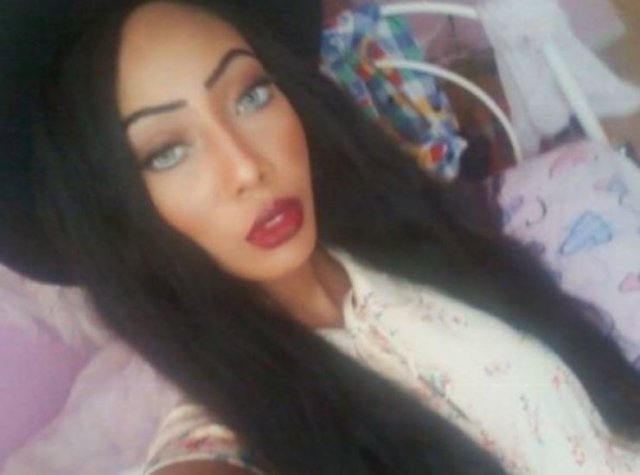 Ruby Doll Sunset Spent Over $200 Thousand On Plastic Surgery (18 pics)