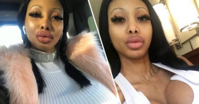 Ruby Doll Sunset Spent Over $200 Thousand On Plastic Surgery (18 pics)