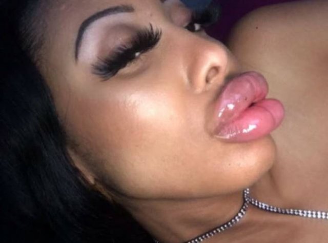 Ruby Doll Sunset Spent Over $200 Thousand On Plastic Surgery (18 pics)