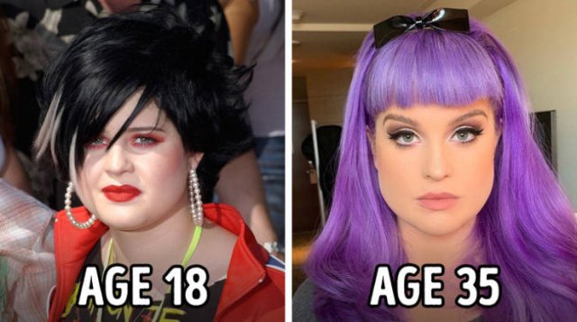Celebrities Who Changed Dramatically (18 pics)