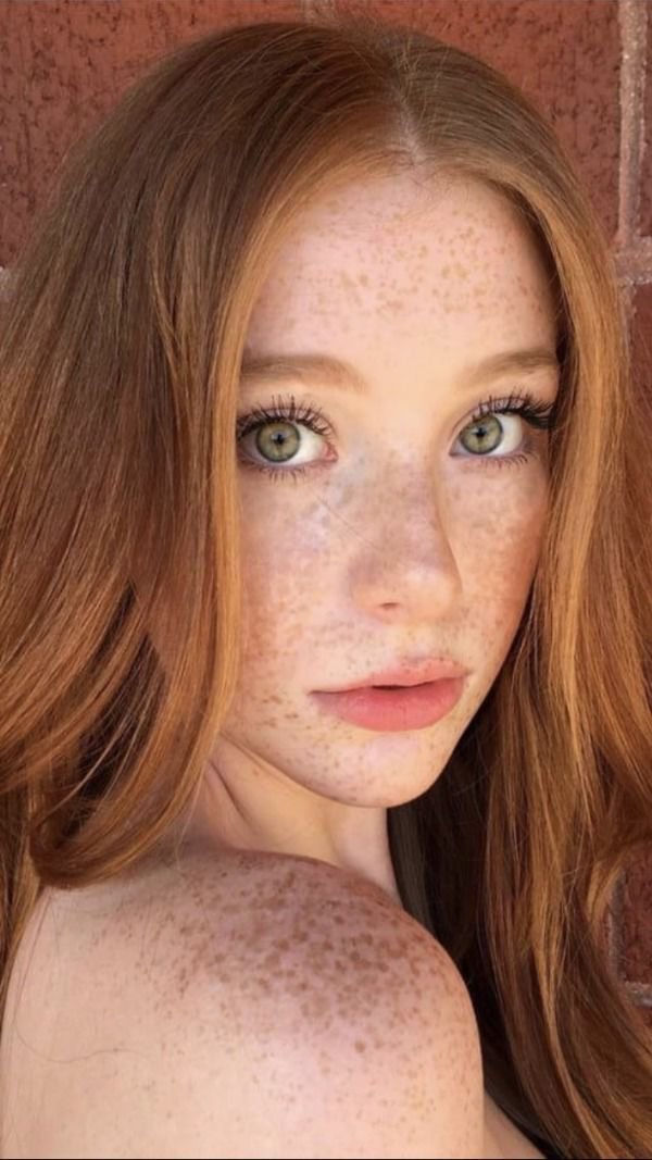 Girls With Freckles (32 pics)