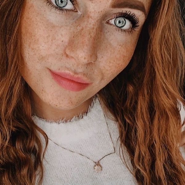 Girls With Freckles (32 pics)