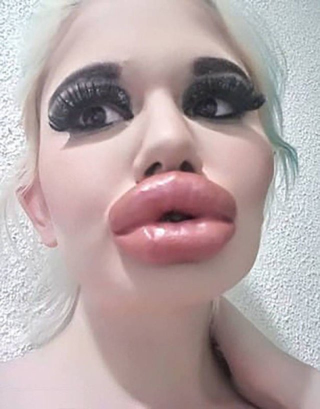 Worlds Largest Pussy Lips