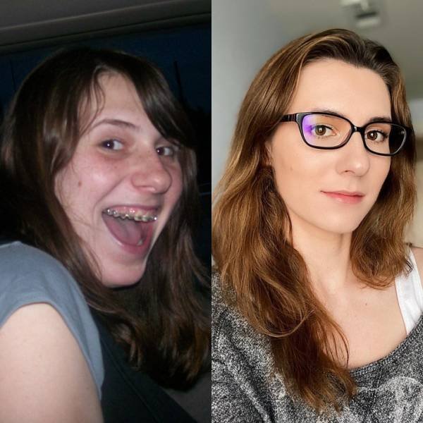People Share Their Changes (20 pics) People Share Their Changes (20 pics)