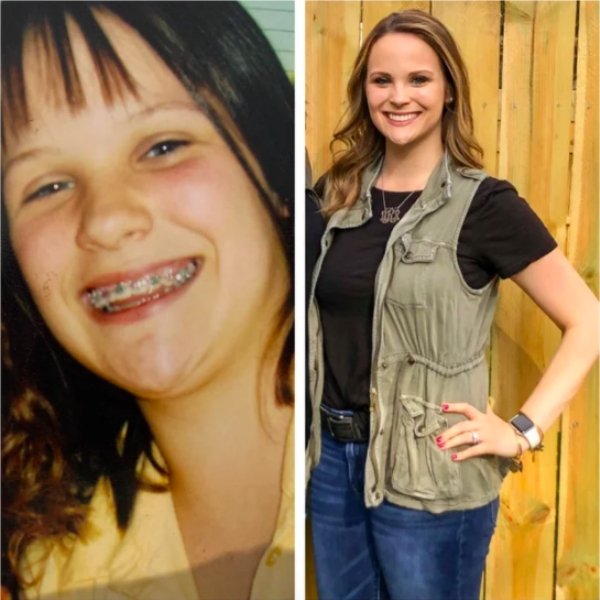 Girls Show Their Dramatic Changes (24 pics)