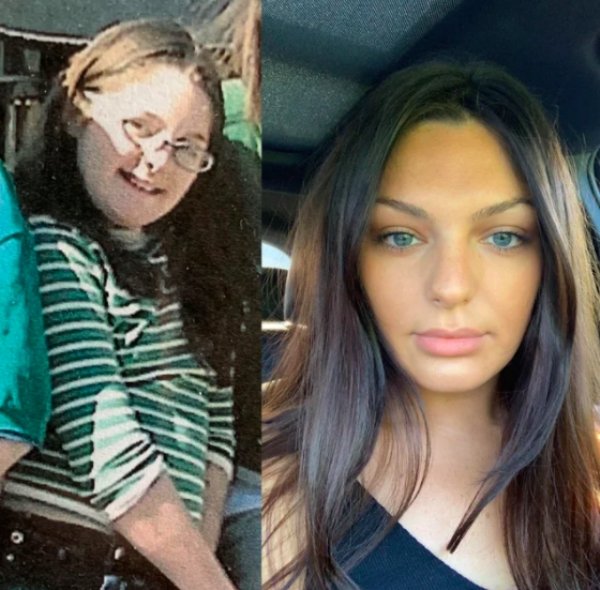 Girls Show Their Dramatic Changes (24 pics)